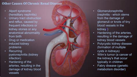 Chronic kidney disease damages the nephrons slowly over several years. Chronic Kidney Disease: Stages of Progression and Impact on Pregnancy - Scientific Animations