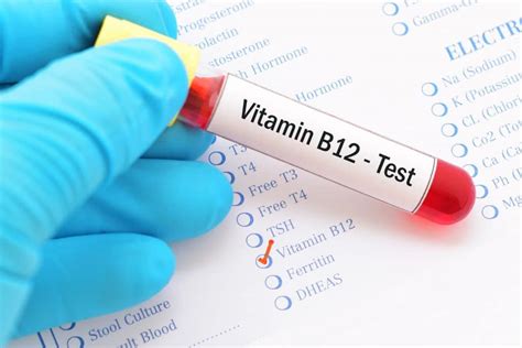 If you check out for vitamin b12 supplements in the market, they are available in 2 forms, methylcobalamin and cyanocobalamin. Vitamin B12 deficiency - symptoms and treatment | Top ...
