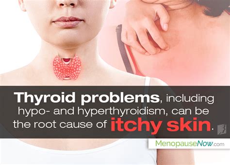 Itchy Skin And Thyroid Problems Are They Related