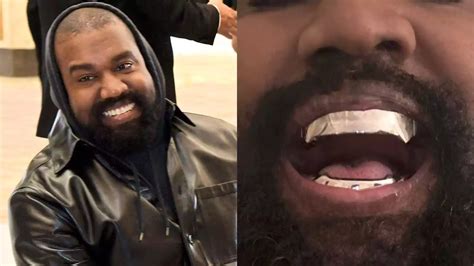 Kanye West Unveils 850k Titanium Dentures Sparking Comparisons To