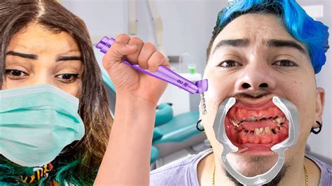 Meus Dentes Ficaram Assim Como Arrancar Dente Youtube