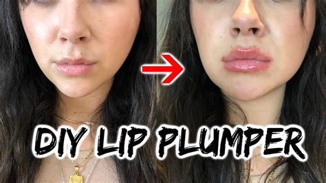Diy Lip Filler Gone Wrong Plastic Surgery Fails 8 Lip Enhancements