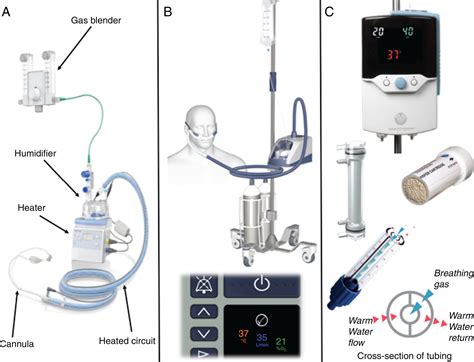 Able to deliver adequately heated and humidified medical gas at flows up to 60 l/min, it is considered to have a number of physiological advantages. The use of high-flow nasal cannula in the pediatric ...