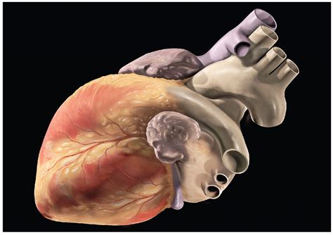 hole in the heart atrial septal defect or ventral septal defect viralflamingo