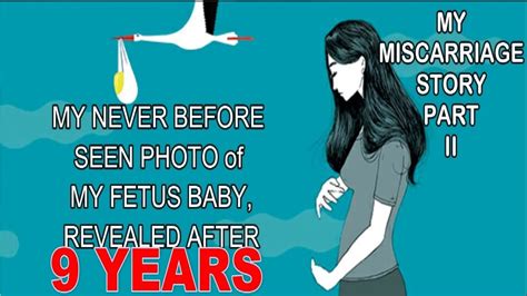 Miscarriage Story Part 2 Tagalog Stop Heartbeat Never Before