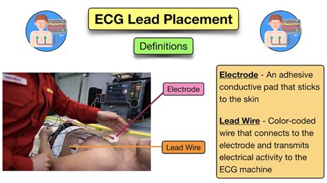 How To Place A 5 Lead Ecg Acronym Mnemonic Diagram For Electrode