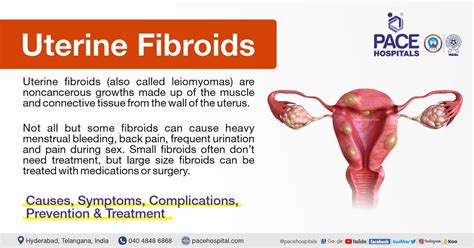 Uterine Fibroids Types Symptoms Treatments Infographi Vrogue Co