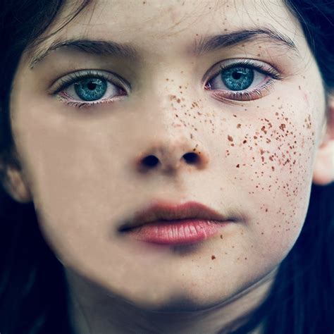 The Birthmark By Nathaniel Hawthorne Beautiful Freckles Freckles Getting Rid Of Freckles