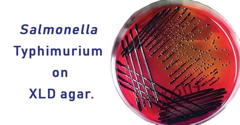 Xld Agar Composition Principle Preparation Results Uses