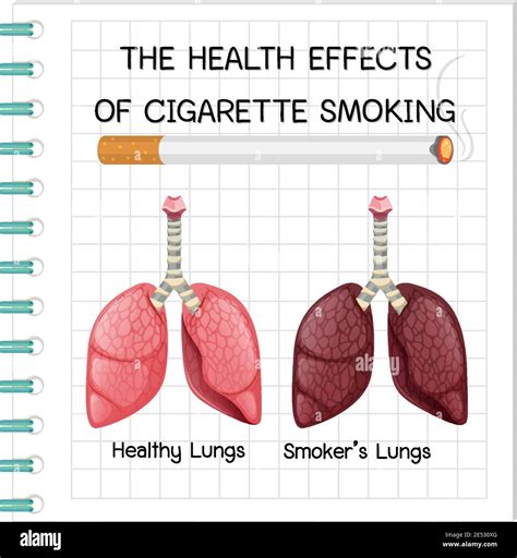 Poster On Health Effects Of Cigarette Smoking Illustration Stock Vector