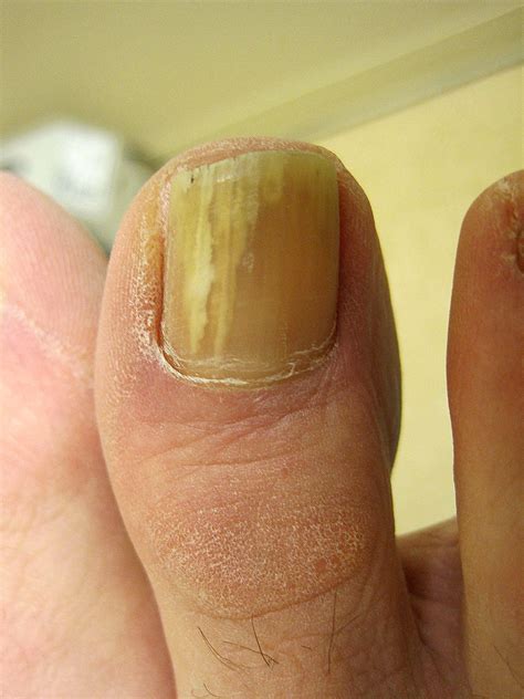 What is a decentralized exchange (dex)? Toenail Polish Fungus | Free Images at Clker.com - vector ...