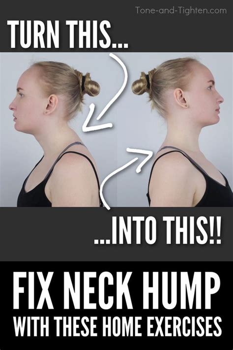 Better Posture Exercises Posture Correction Exercises Neck Exercises Facial Exercises Neck
