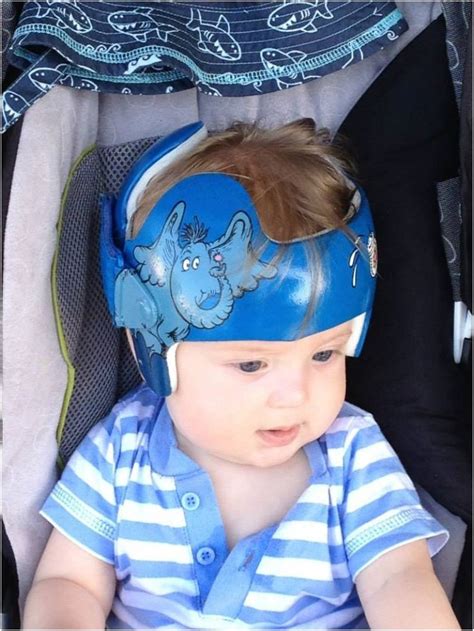 20 Cute And Fun Helmets For Babies With Plagiocephaly Fun Helmets