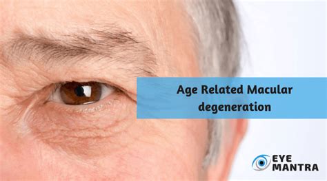 Macular Degeneration Amd Causes And Treatment Eyemantra