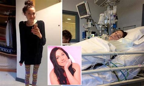 Mother Releases Photos Of Anorexic Daughter Emma Duffy Whi Who Hasnt Eaten For A Year Daily