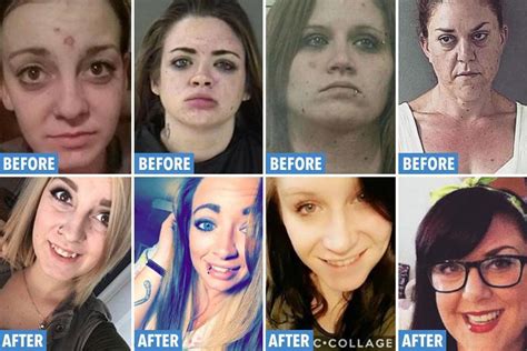 Shocking Before And After Photos Show The Devastating Impact Of Drug