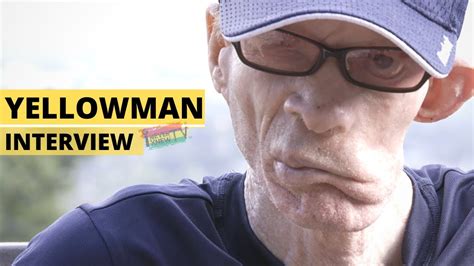 From Scorned Orphan To King Of Dancehall Yellowman Interview Youtube