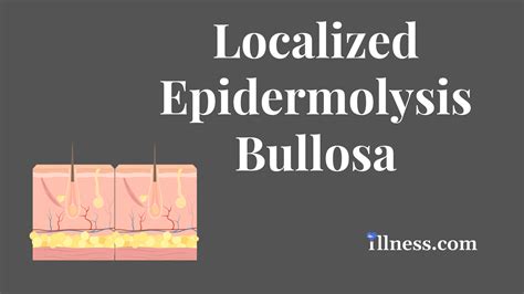 Localized Epidermolysis Bullosa Overview Causes Symptoms Treatment
