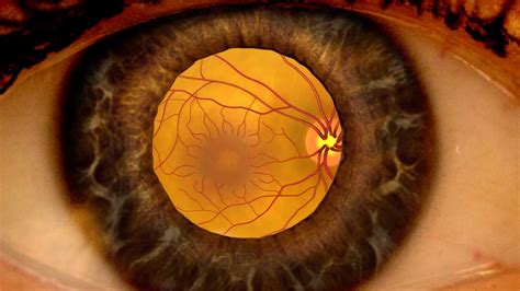 Eylea Outperforms Other Drugs For Diabetic Macular Edema With Moderate