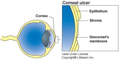 Squinting and sensitivity to bright light. Corneal Ulcer In Dogs & Cats | Eye Ulcers & Treatment