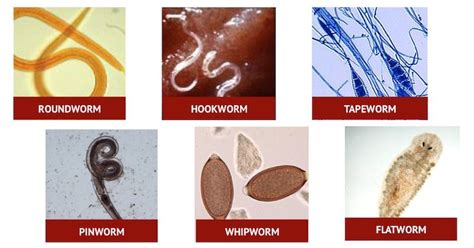 Types Of Parasitic Worms In Humans