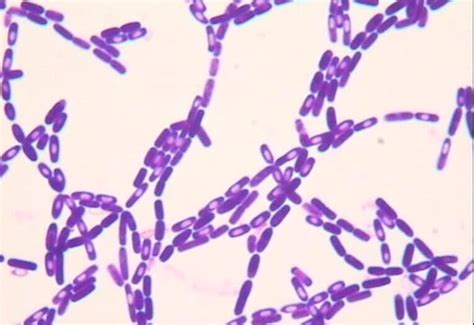 Bacillus Cereus