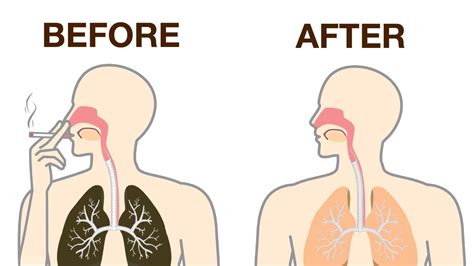 How To Naturally Detox Nicotine From Your Body Power Of Positivity