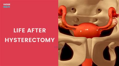 Life After Hysterectomy YouTube