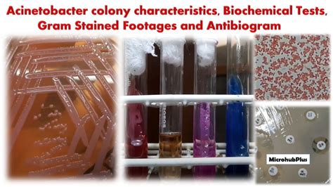 Acinetobacter Colony Characteristics Biochemical Tests Gram Stained