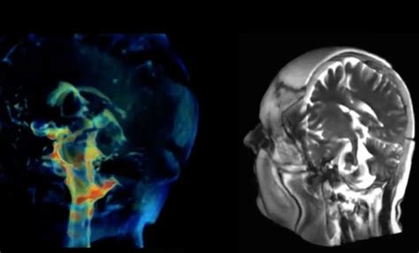 New Imaging Technique Captures How Brain Moves Wordlesstech