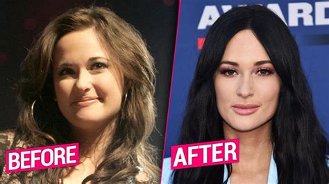 Kacey Musgraves Plastic Surgery Transformation Exposed
