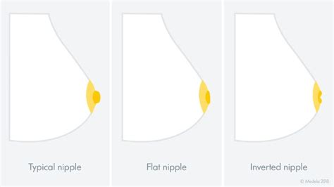 Breastfeeding With Flat Inverted Or Pierced Nipples Medela