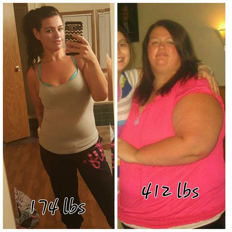 Gastric Bypass Weight Loss Before And After Pictures Before And After