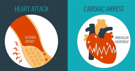 Heart Attack Vs Cardiac Arrest Whats The Difference