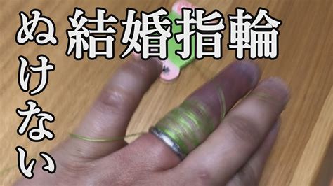 【悲鳴・グロ注意】結婚指輪が抜けないくらい指がパンパンに腫れてしまった Youtube