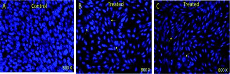 DAPI Stained HCT 116 Cells A Control Nontreated B Treated 7i