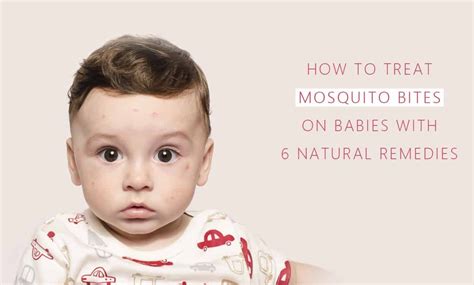 80 Best Of How To Treat Mosquito Bites On Babies Insectza