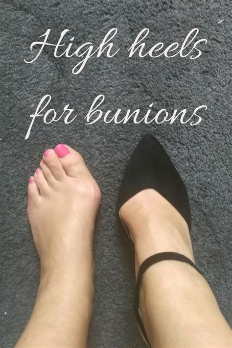 Pin On Beautiful Shoes For Bunions