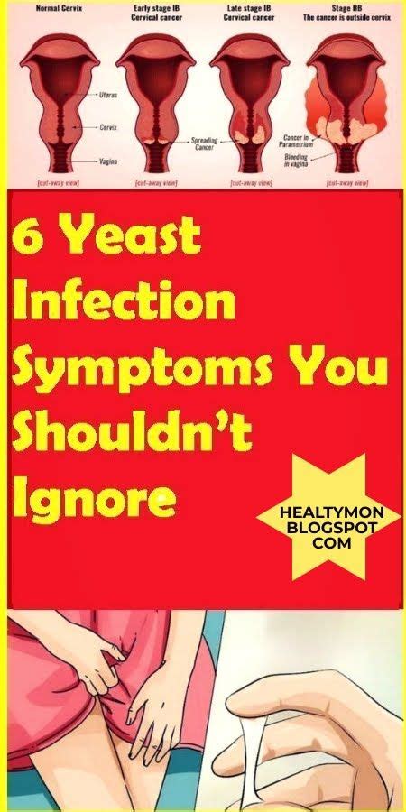 6 Yeast Infection Symptoms You Shouldnt Ignore Yeast Infection