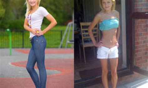 From Anorexic Teenager To Beauty Queen Uk News Uk