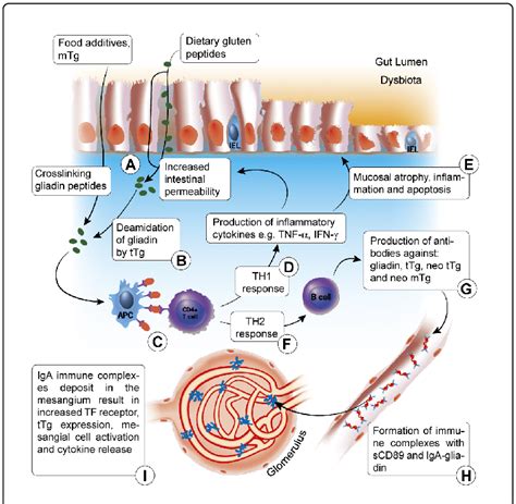 Summary Of The Involvement Of Gluten In Iga Nephropathy Pathogenesis Download Scientific Diagram