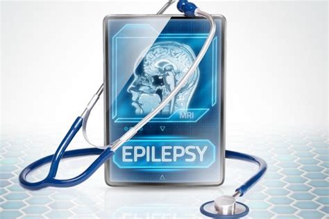Epilepsi Hastal Nedir E Itleri Belirtileri Ve Tedavisi Nefis