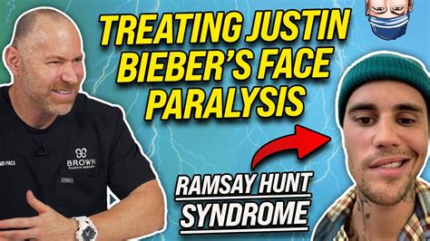 Treating Justin Bieber S Ramsay Face Paralysis Youtube