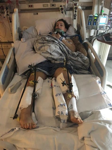Mcqueen Grad Hit By Suspected Drunk Driver Could Lose Legs