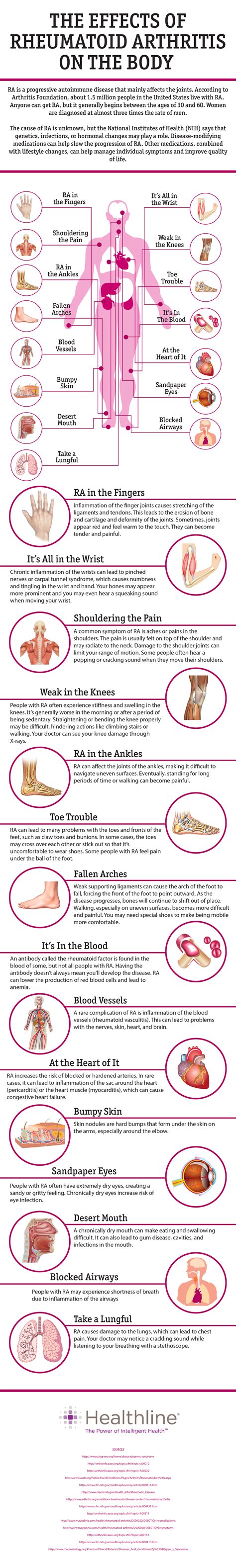 15 Effects Of Rheumatoid Arthritis On The Body