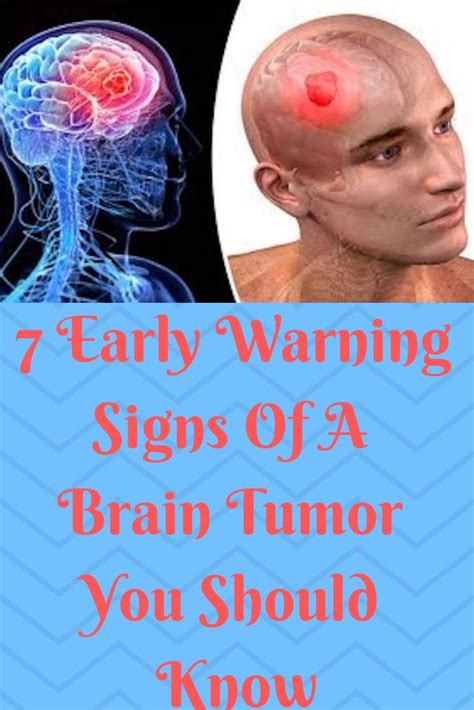 7 Early Warning Signs Of A Brain Tumor You Should Know Brain Tumor Tumor Gynecological Cancer