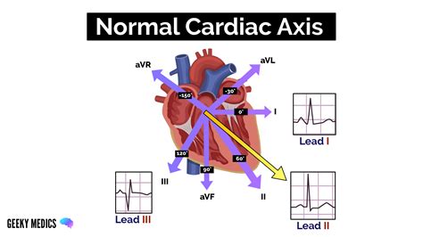 How To Read An Ecg Ecg Interpretation Ekg Geeky Medics