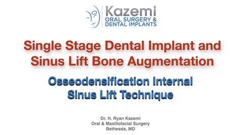 Single Stage Dental Implant Placement And Sinus Lift Bone Graft Using