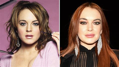 Did Lindsay Lohan Get Plastic Surgery Transformation Photos