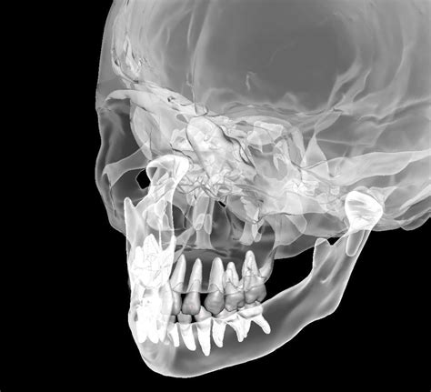 Human Child Skull Anatomy Model With Individual Teeth 3d Model 3d